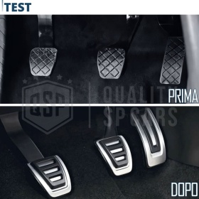 Car PEDAL Covers for Skoda Scala MANUAL Transmission | Aluminum and Non-slip Rubber Sports Pedals Car PEDAL Covers for Skoda Scala MANUAL Transmission | Aluminum and Non-slip Rubber Sports Pedals